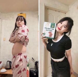 Sau 3 tháng sử dụng - Giảm 20kg và 25cm bụng